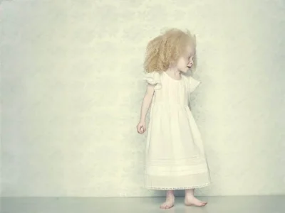 Albino Nedir ?